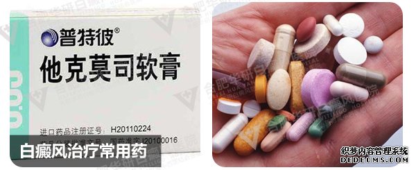孩子白癜风吃什么药不会伤害身体